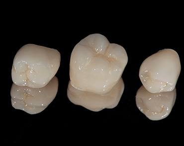 Dental crowns lying on a table