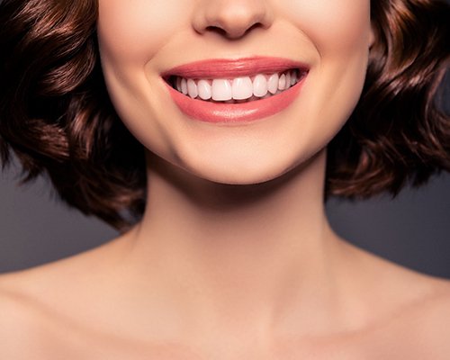 Closeup of woman smiling with veneers in Las Vegas