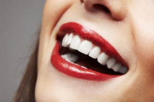 porcelain veneers smile