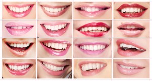 teeth whitening summerlin