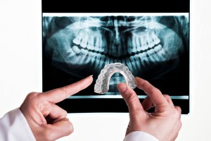 Teeth grinding damages tooth enamel and leads to other health problems. Summerlin dentist, Dr. Pamela West, provides precise solutions for bruxism.