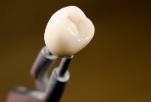 Solution to black line around a dental crown