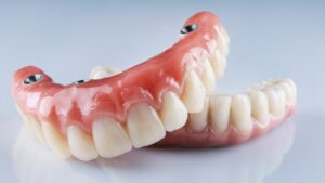 Implant dentures on a grey table